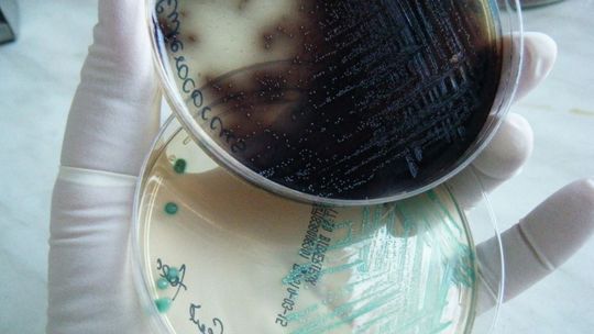 Bakterie coli w wodzie