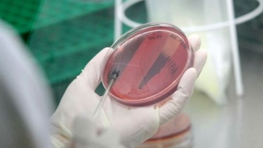 Bakterie grupy coli wykryto w wodzie