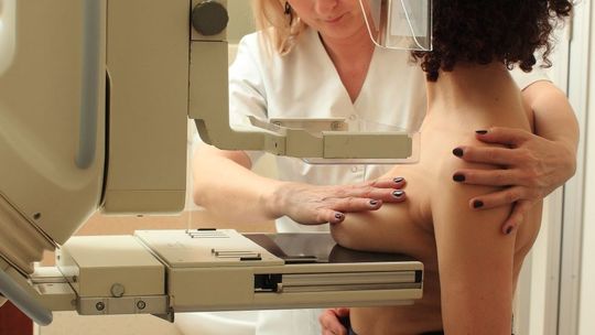 Bezpłatne badania dla kobiet