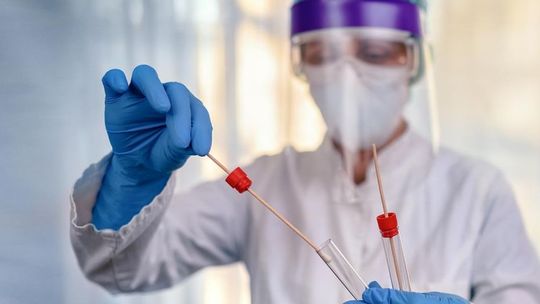 Darmowe badania na koronawirusa zrobisz w Mieszkowicach i Moryniu