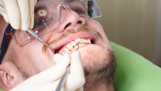 Polacy coraz częściej leczą zęby w Ukrainie. Cennik ukraińskiego dentysty