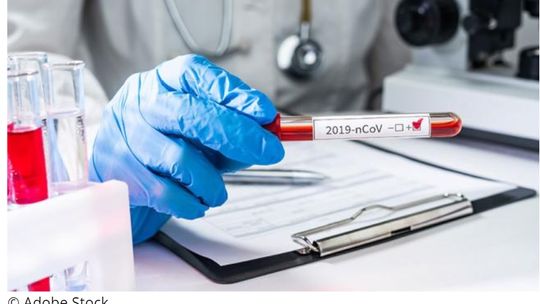 Dokonujemy miarodajnego porównania sytuacji epidemicznej