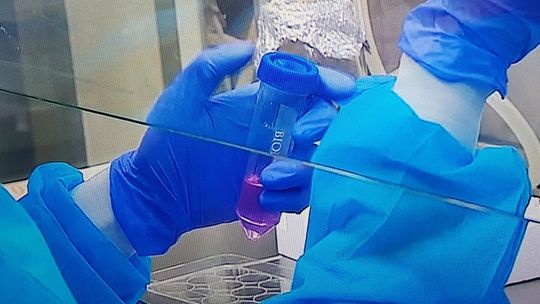 Dziś obserwujemy wzrosty zakażeń koronawirusem