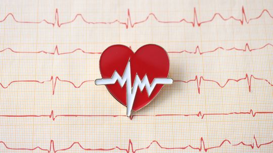EKG serca – na czym polega i co wykrywa?