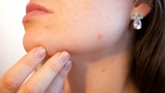 Kiedy udać się do dermatologa?