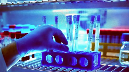 Kolejna osoba zakażona koronawirusem w Zachodniopomorskiem