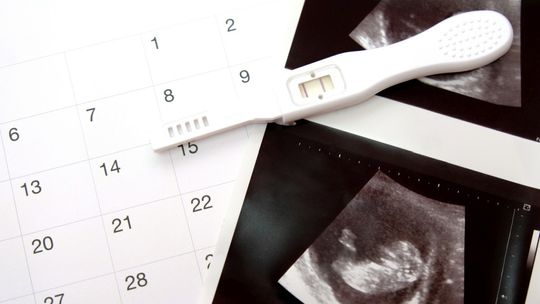 W Polsce zagrożone są kobiety w ciąży. Legalna aborcja zniknęła