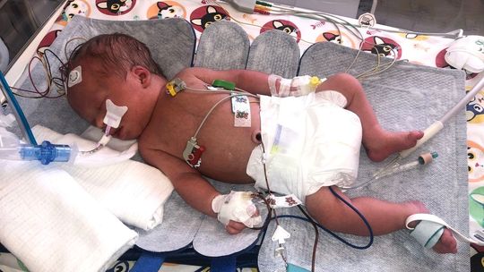 Nowoczesny sprzęt od WOŚP ratuje kolejne maluchy w szpitalu