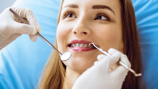 Pierwsza wizyta u ortodonty: kiedy i dlaczego aparat ortodontyczny u dziecka jest najlepszą inwestycją w przyszły uśmiech?