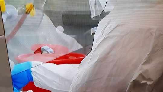 Pierwsze potwierdzone zakażenie koronawirusem w powiecie gryfińskim! 31 osób zakażonych w Zachodniopomorskiem