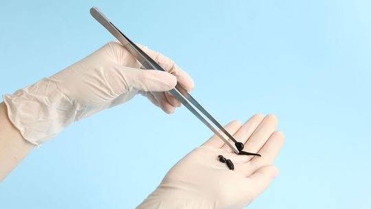 Pijawki a cukrzyca – jak hirudoterapia może wspomóc terapię tej choroby? Pijawki a cukrzyca – jak hirudoterapia może wspomóc terapię tej choroby?