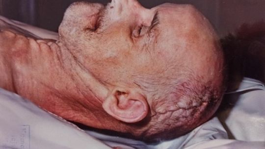 Policja prosi o pomoc w ustaleniu, kto to jest [DRASTYCZNE ZDJĘCIA]