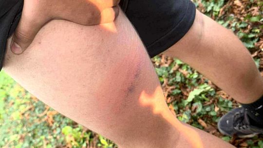 Policja przyznaje się do użycia pałki podczas interwencji, ale czy do uderzenia 13-latka?