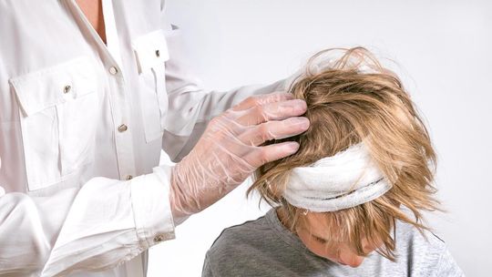 Pomagaj osobom zmagającym się z dolegliwościami skóry głowy – odkryj profesję trychologa!