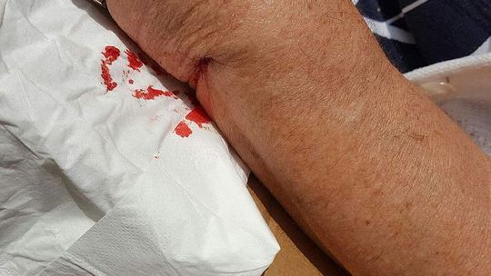 Pracował na terenie Zalando. Gdy znalazł się w szpitalu, okazało się, że ma problem z ubezpieczeniem