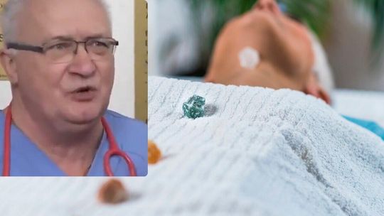 Pseudomedycyna i niebezpieczne terapie. Prof. Simon ujawnia, jak szarlatani żerują na pacjentach
