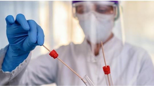 Przetestuj bezpłatnie, czy miałeś kontakt z wirusem SARS CoV-2 i wytworzyłeś przeciwciała