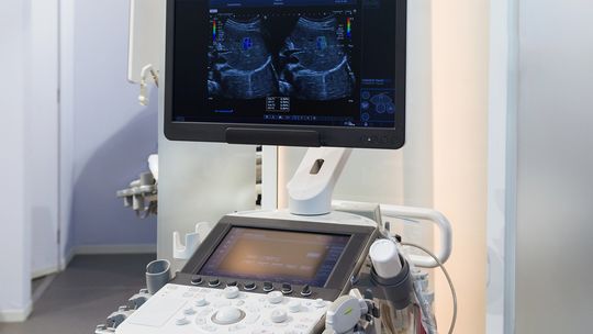 USG jąder: Kiedy jest niezbędne i dlaczego profilaktyka jest kluczem do męskiego zdrowia?