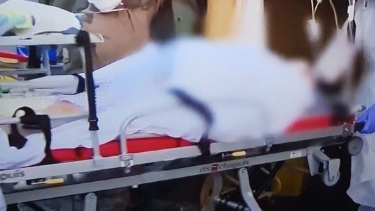 W naszym powiecie zmarła osoba zakażona koronawirusem