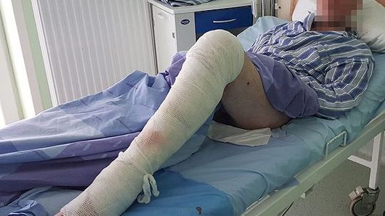 Wojewoda decyduje o zamknięciu dwóch oddziałów szpitala