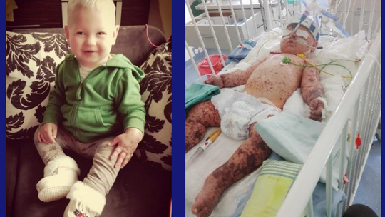 Wyprzedź sepsę – ochroń swoje dziecko!