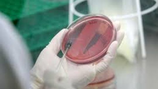 Zanieczyszczona woda w gminie Gryfino