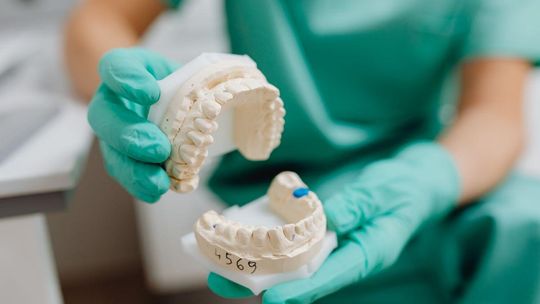 Zęby coraz droższe... Lekarki skazane za naciąganie NFZ