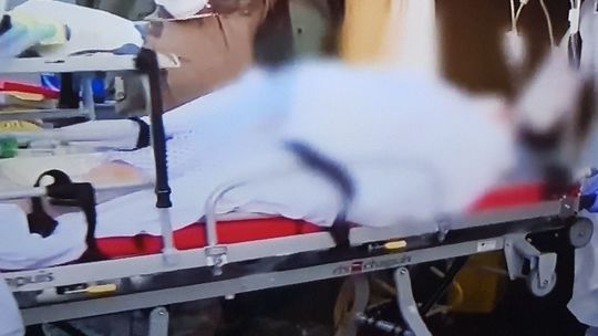 Zmarła zakażona koronawirusem