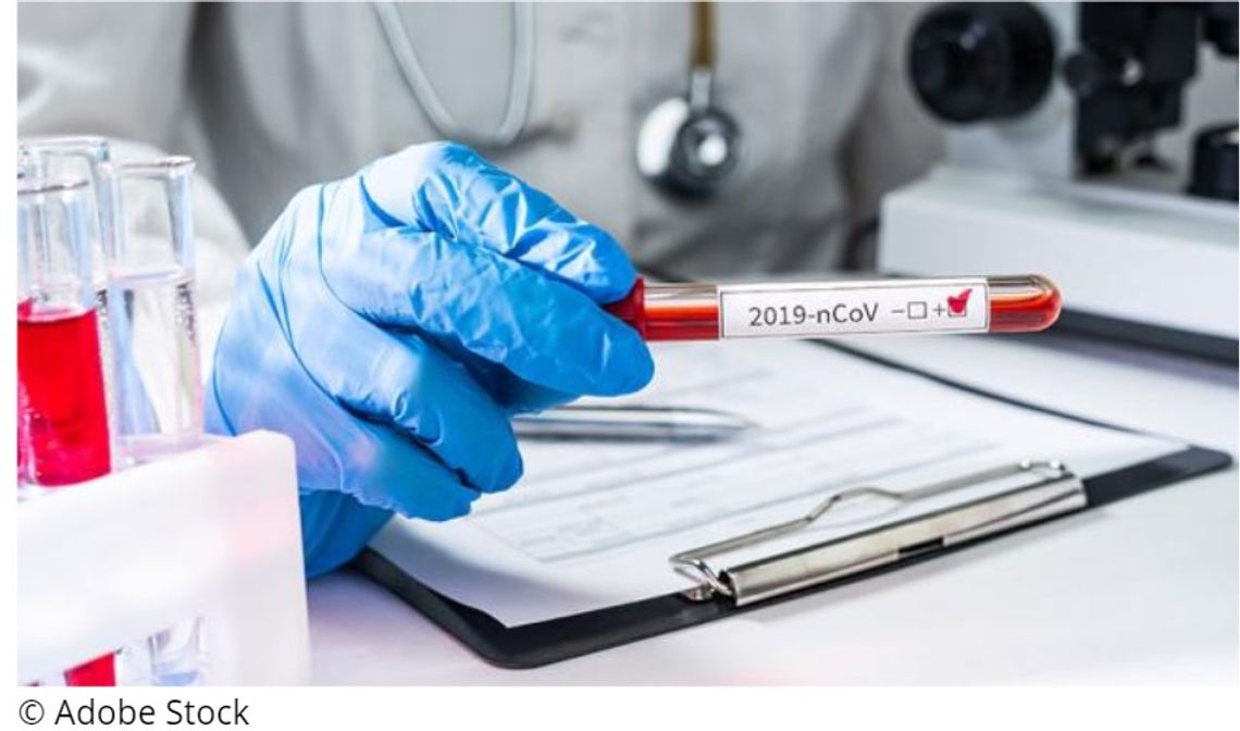 26 osób zakażonych wirusem SARS-CoV-2 w Zachodniopomorskiem 26 osób zakażonych wirusem SARS-CoV-2 w Zachodniopomorskiem