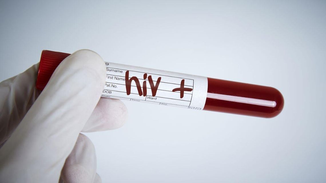 Rośnie liczba zakażeń HIV. W większości nie wiadomo, jak dokładnie do tego doszło
