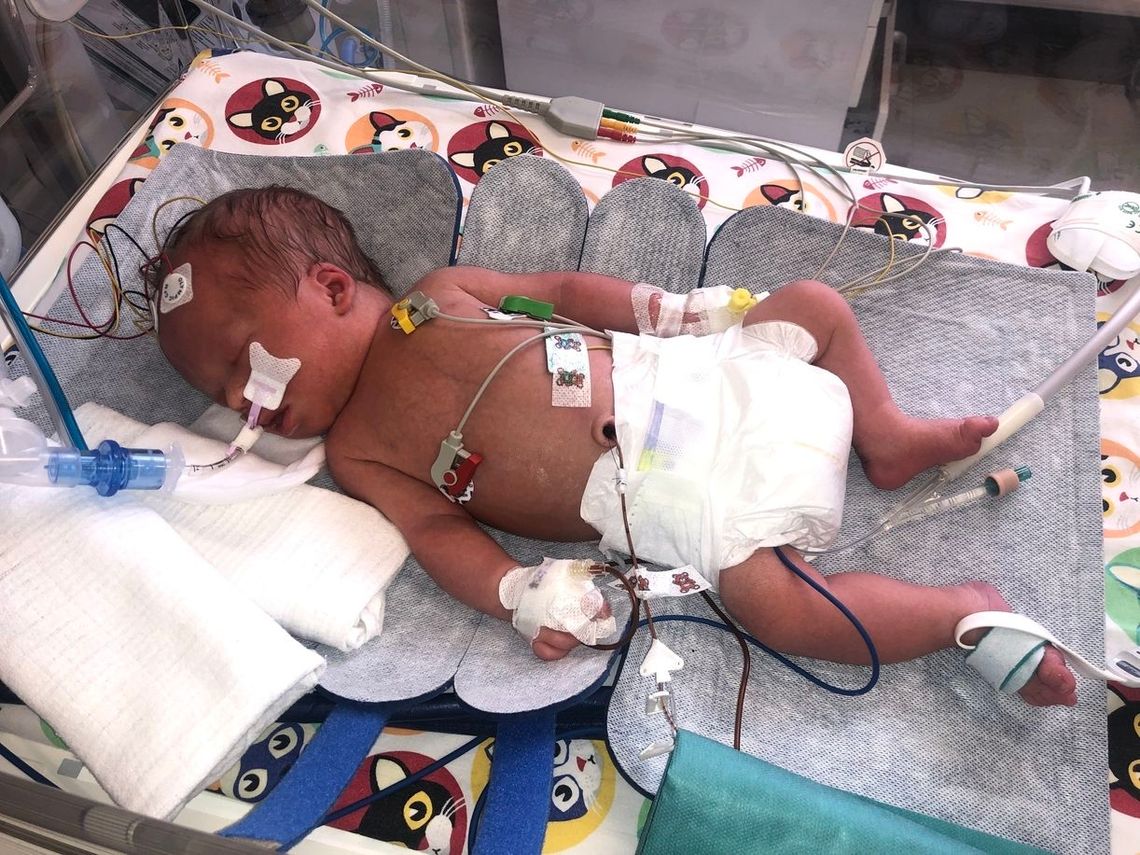 Nowoczesny sprzęt od WOŚP ratuje kolejne maluchy w szpitalu Nowoczesny sprzęt od WOŚP ratuje kolejne maluchy w szpitalu