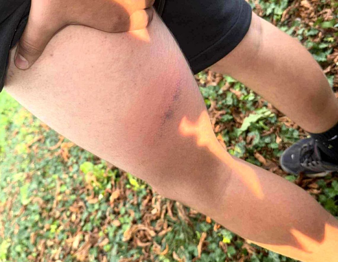 Policja przyznaje się do użycia pałki podczas interwencji, ale czy do uderzenia 13-latka?