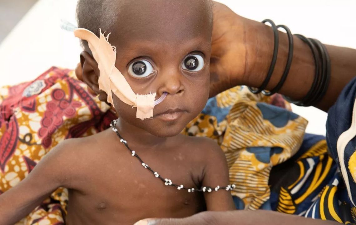 Przegrywamy walkę z niedożywieniem, alarmuje UNICEF, WFP, FAO, WHO i IFAD