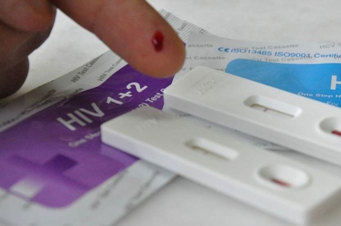 Punkt diagnostyki HIV w nowym miejscu