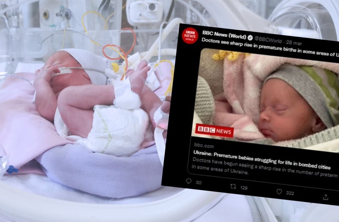 Wojna w Ukrainie. Wcześniaki walczą o życie w bombardowanych piwnicach Wojna w Ukrainie. Wcześniaki walczą o życie w bombardowanych piwnicach