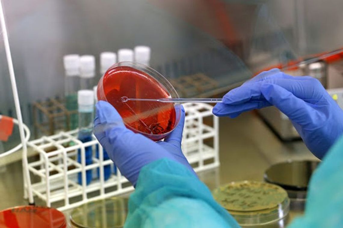 Wynik badania na koronawirusa negatywny Wynik badania na koronawirusa negatywny