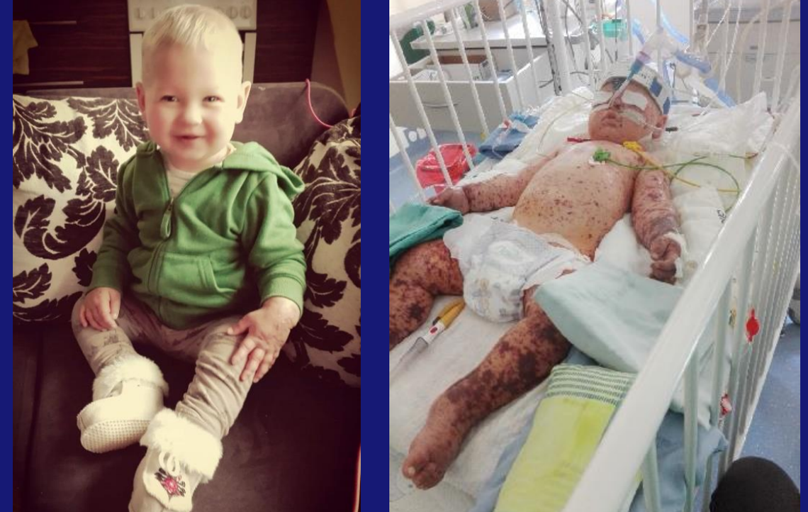 Wyprzedź sepsę – ochroń swoje dziecko! Wyprzedź sepsę – ochroń swoje dziecko!