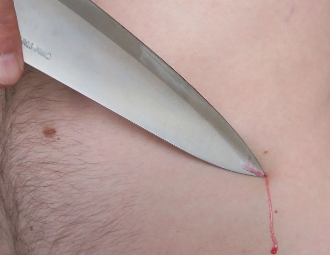 Zadał cios nożem. Policja wyjaśnia, jak doszło do tragedii Zadał cios nożem. Policja wyjaśnia, jak doszło do tragedii