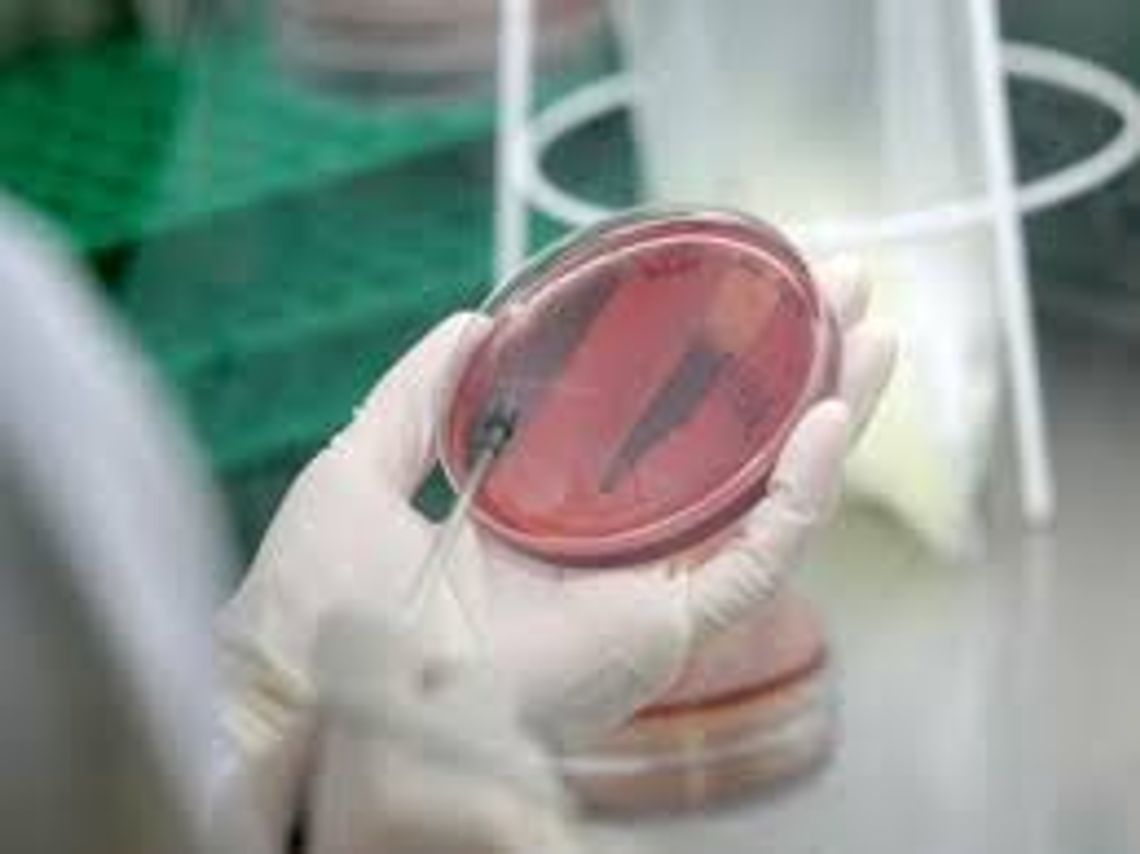 Zanieczyszczona woda w gminie Gryfino