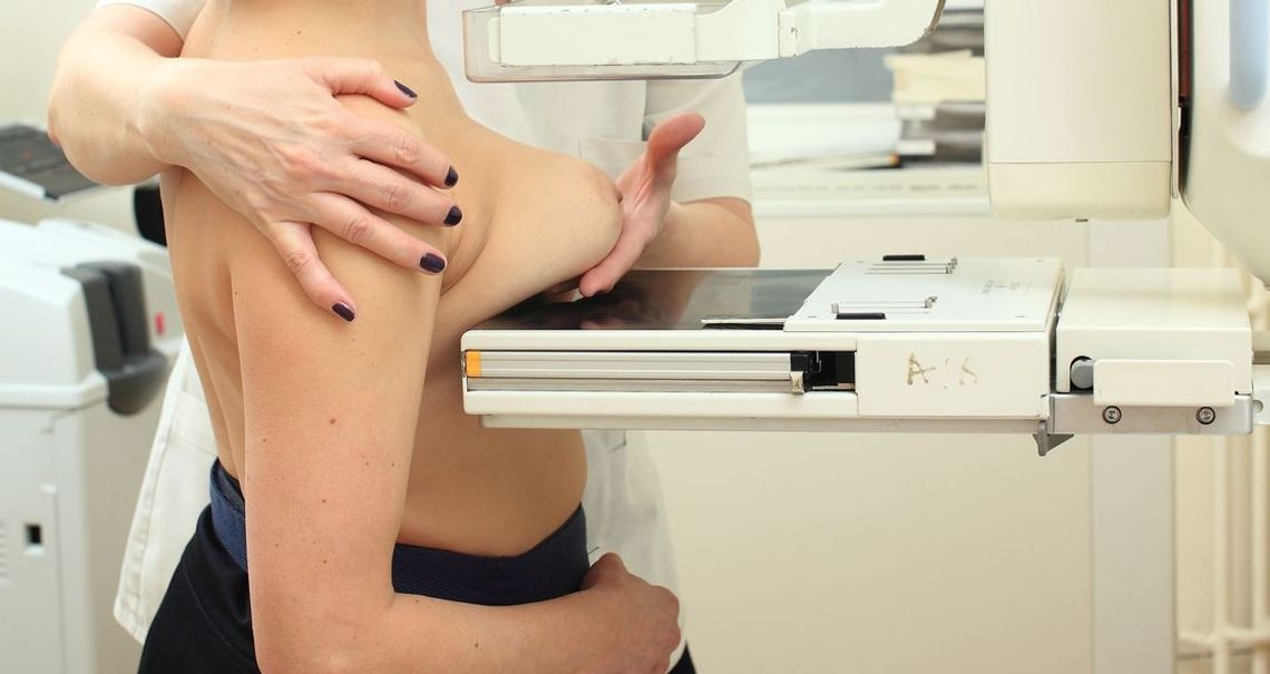 Zapraszają na badania mammograficzne do Gryfina Zapraszają na badania mammograficzne do Gryfina