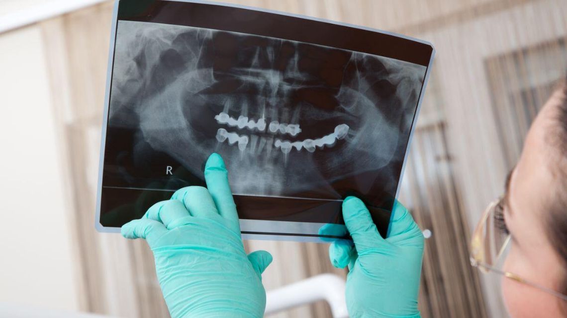 Lekarze wolą leczyć prywatnie i uciekają z NFZ. Skomplikowana papierologia odrzuca dentystów Lekarze wolą leczyć prywatnie i uciekają z NFZ. Skomplikowana papierologia odrzuca dentystów